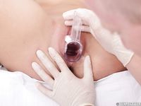 miközben meglátogatja a nőgyógyászát."