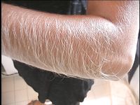 Furry-Armed Lori Anderson