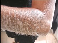 Furry-Armed Lori Anderson