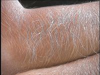 Furry-Armed Lori Anderson