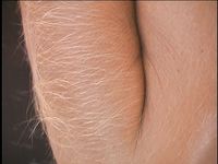 Furry-Armed Lori Anderson