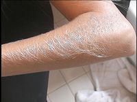 Furry-Armed Lori Anderson